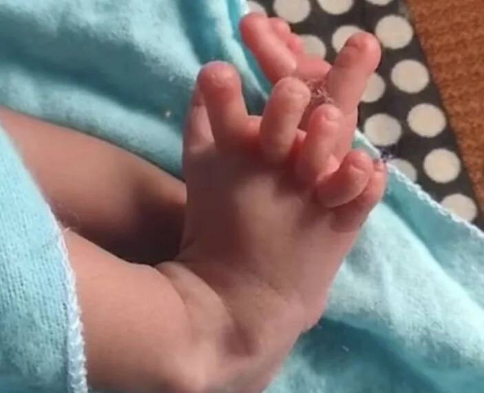 Dünya bu olayı konuşuyor: 26 parmakla doğan bebeği tanrıça ilan ettiler 5