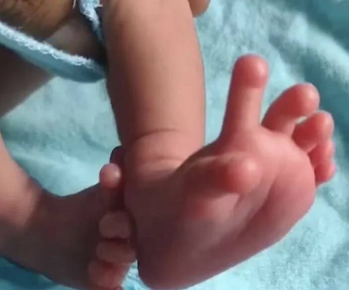 Dünya bu olayı konuşuyor: 26 parmakla doğan bebeği tanrıça ilan ettiler 9