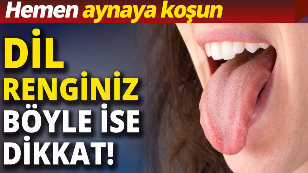 Dil rengi böyle olanlar dikkat! Hemen aynaya koşun! 1