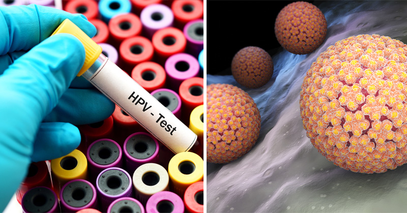 HPV testi nasıl yapılır ‘HPV testi nedir kimlere yapılır