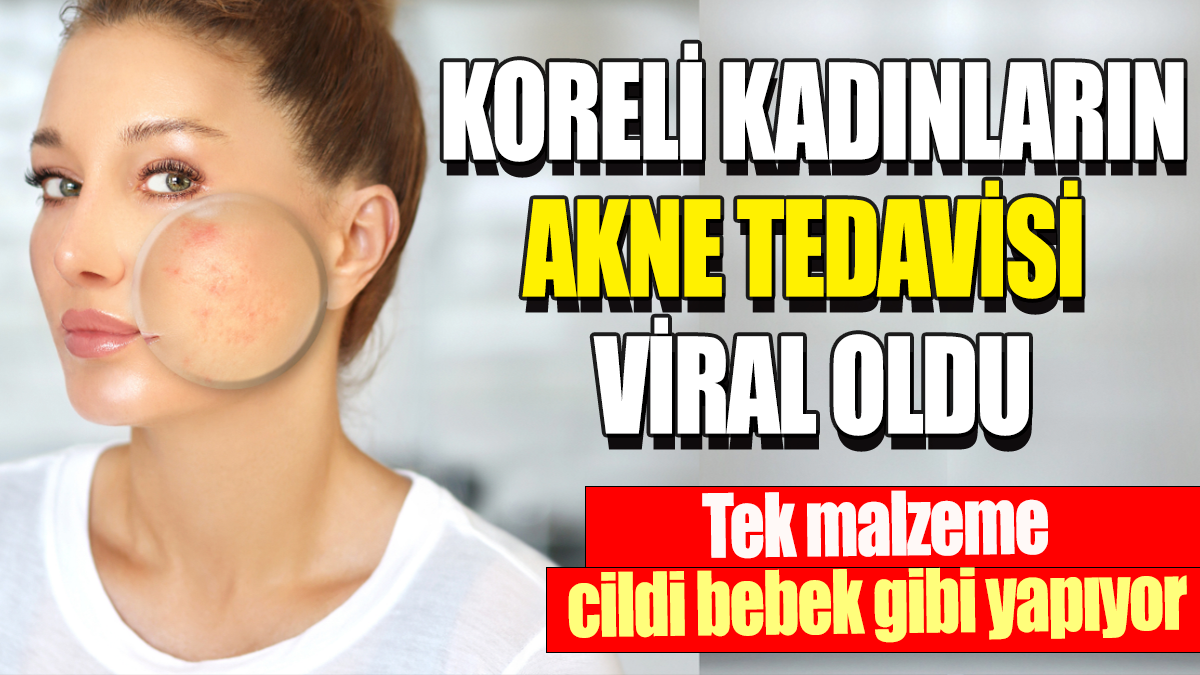 Koreli kadınları akne tedavisi viral oldu: Tek malzeme cildi bebek gibi yapıyor