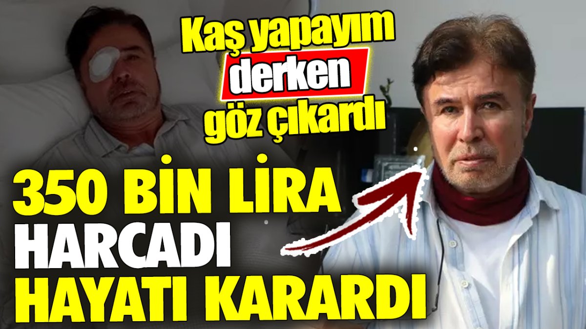 350 bin lira harcadı hayatı karardı ‘Kaş yapayım derken göz çıkardı'