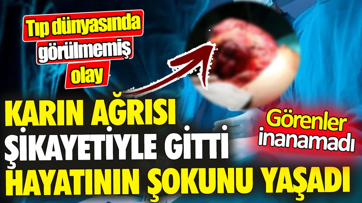 Tıp dünyasında görülmemiş olay! Karın ağrısı şikayetiyle gitti hayatının şokunu yaşadı 'Görenler inanamadı'