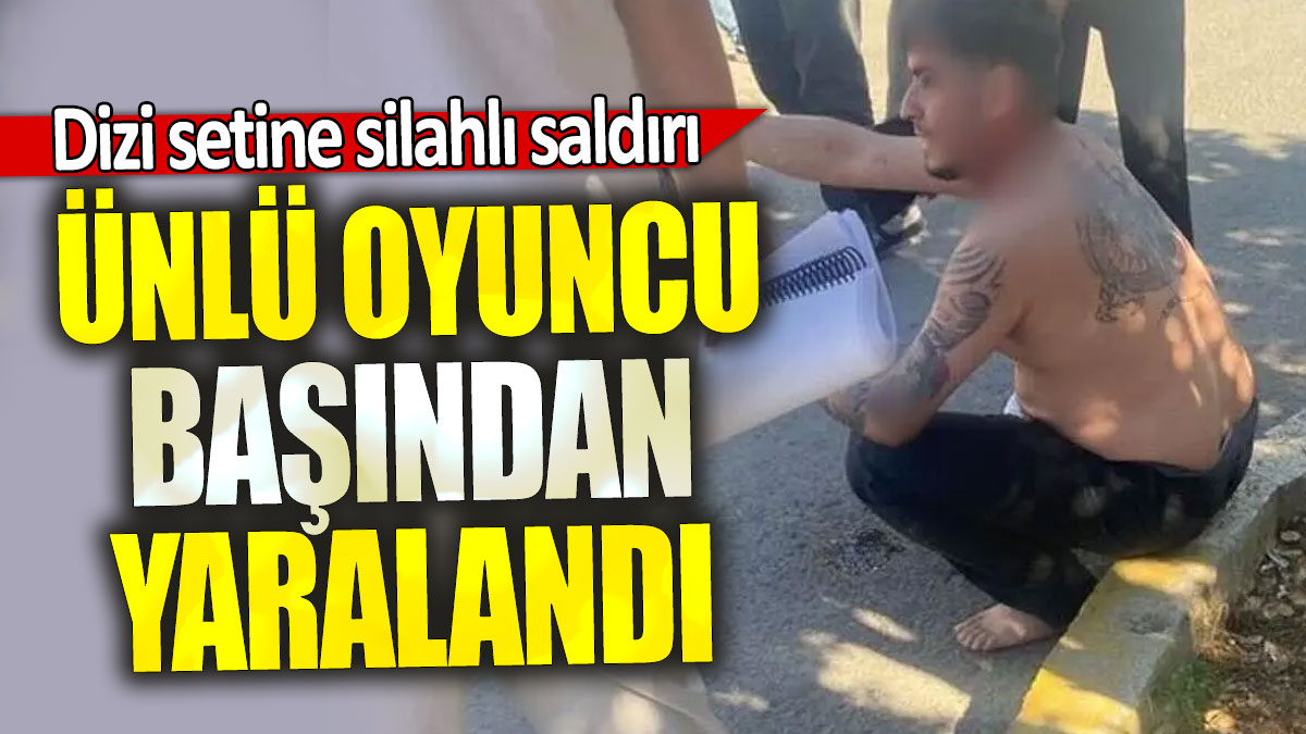 Dizi setine silahlı saldırı: Cengizhan Yurdutek başından yaralandı