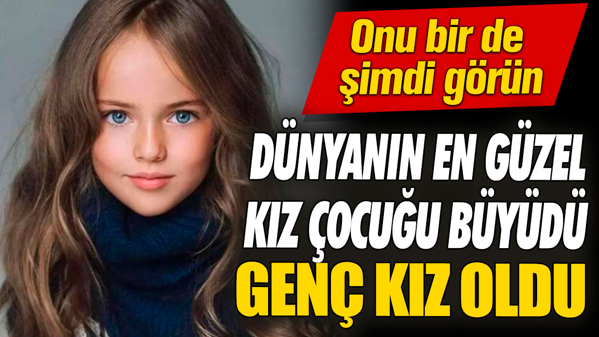 Dünyanın en güzel kız çocuğu büyüdü genç kız oldu! Onu bir de şimdi görün