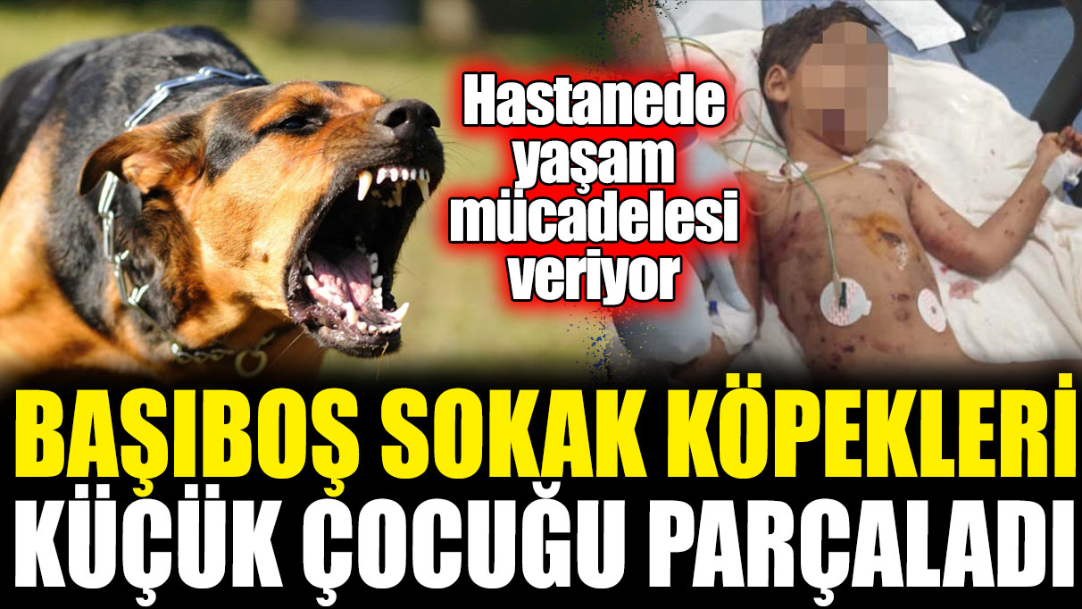 Başıboş sokak köpekleri küçük çocuğu parçaladı! Hastanede yaşam mücadelesi veriyor