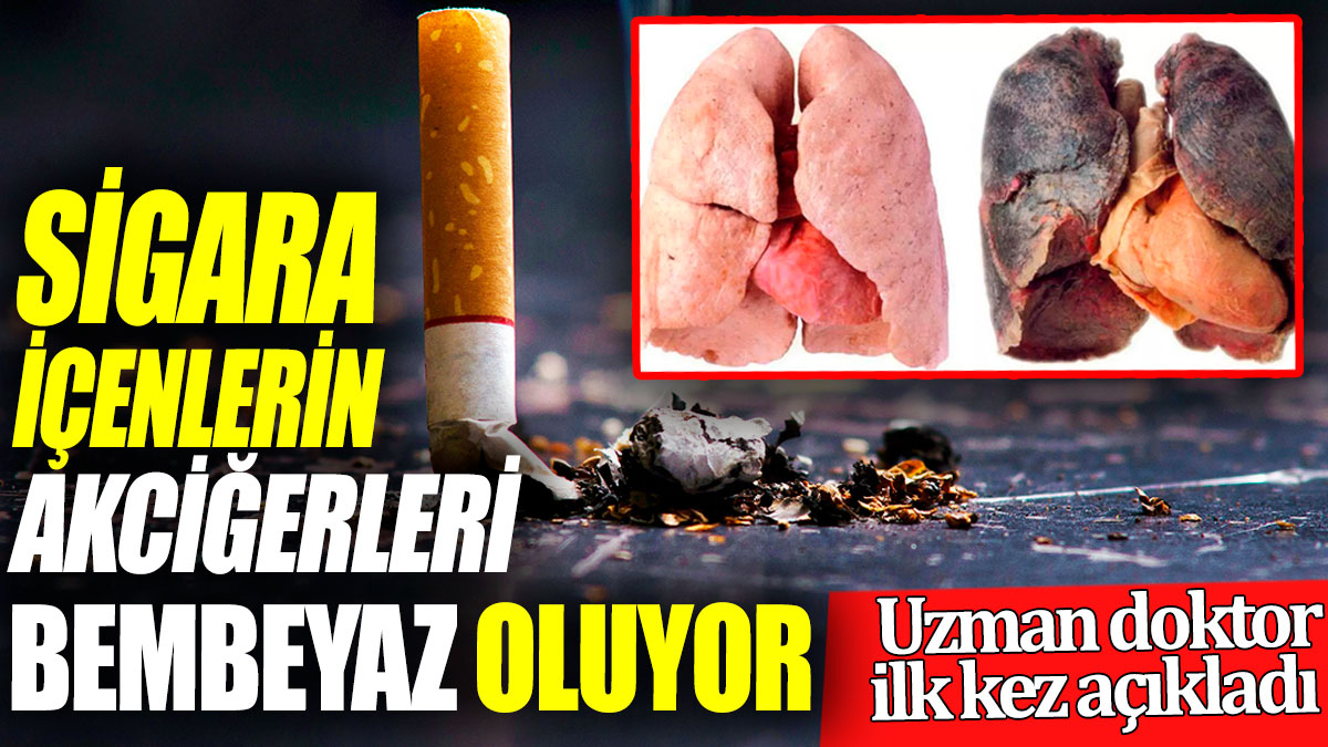 Sigara içenlerin akciğeri bembeyaz oluyor! Uzman doktor ilk kez açıkladı