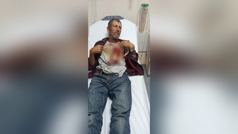 Hayvan otlatırken yaban domuzunun saldırısına uğradı