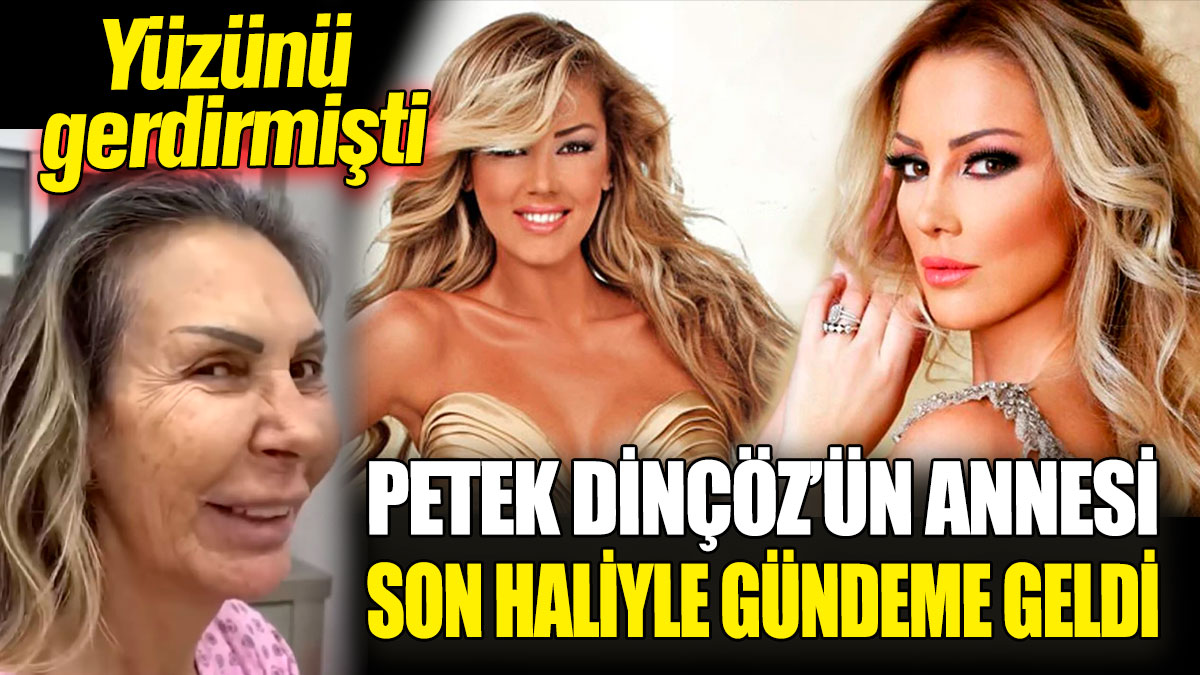 Petek Dinçöz’ün annesi son haliyle gündeme geldi! Yüzünü gerdirmişti