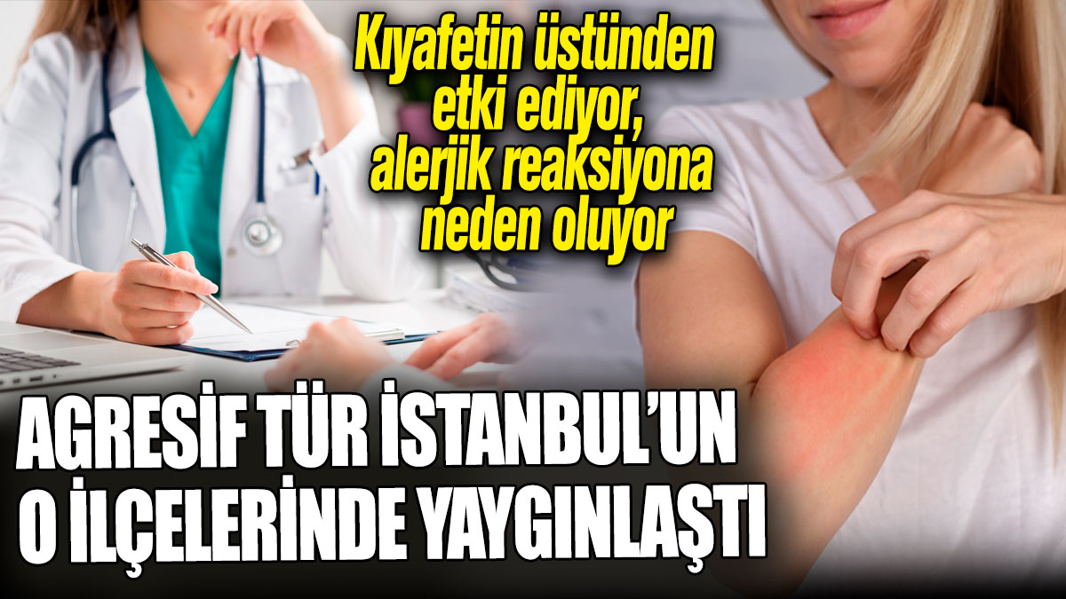 Agresif tür İstanbul’un o ilçelerinde yaygınlaştı! Kıyafetin üstünden ısırıyor, alerjik reaksiyona neden oluyor