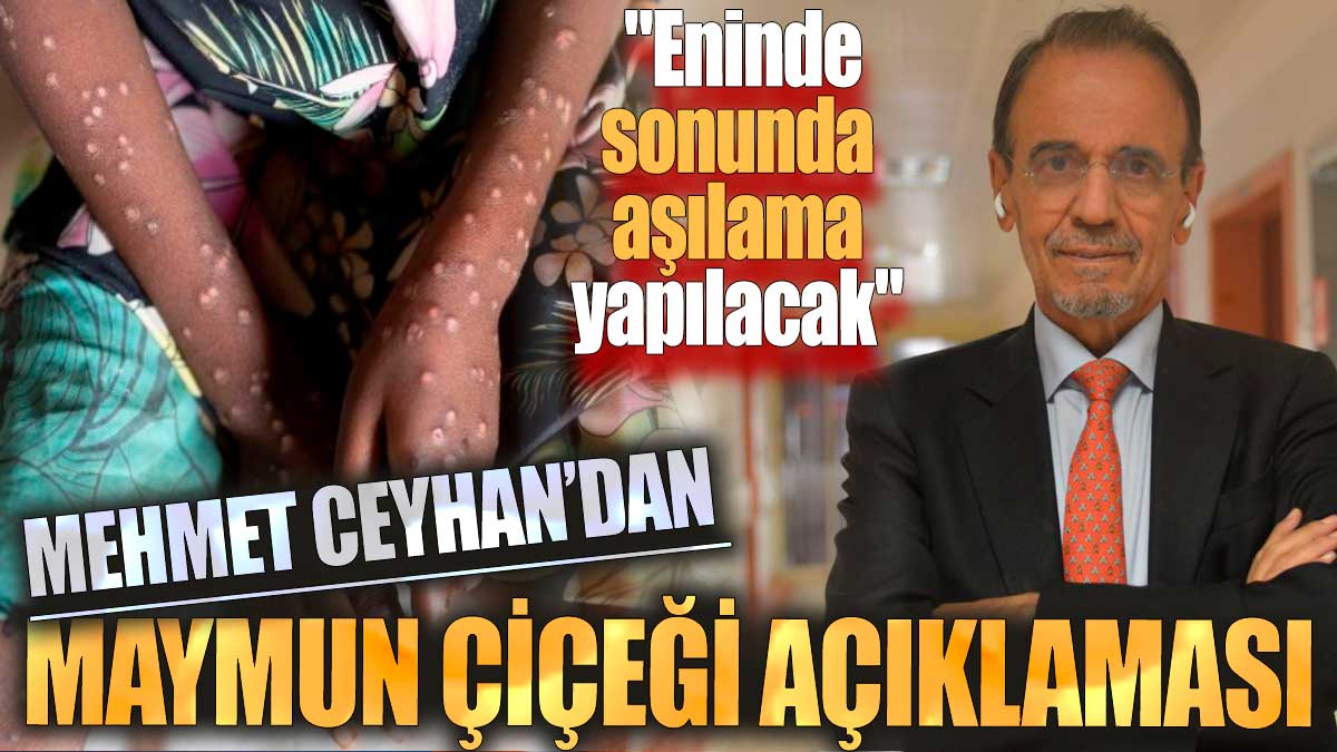 Mehmet Ceyhan'dan Maymun Çiçeği açıklaması: "Eninde sonunda aşılama yapılacak"