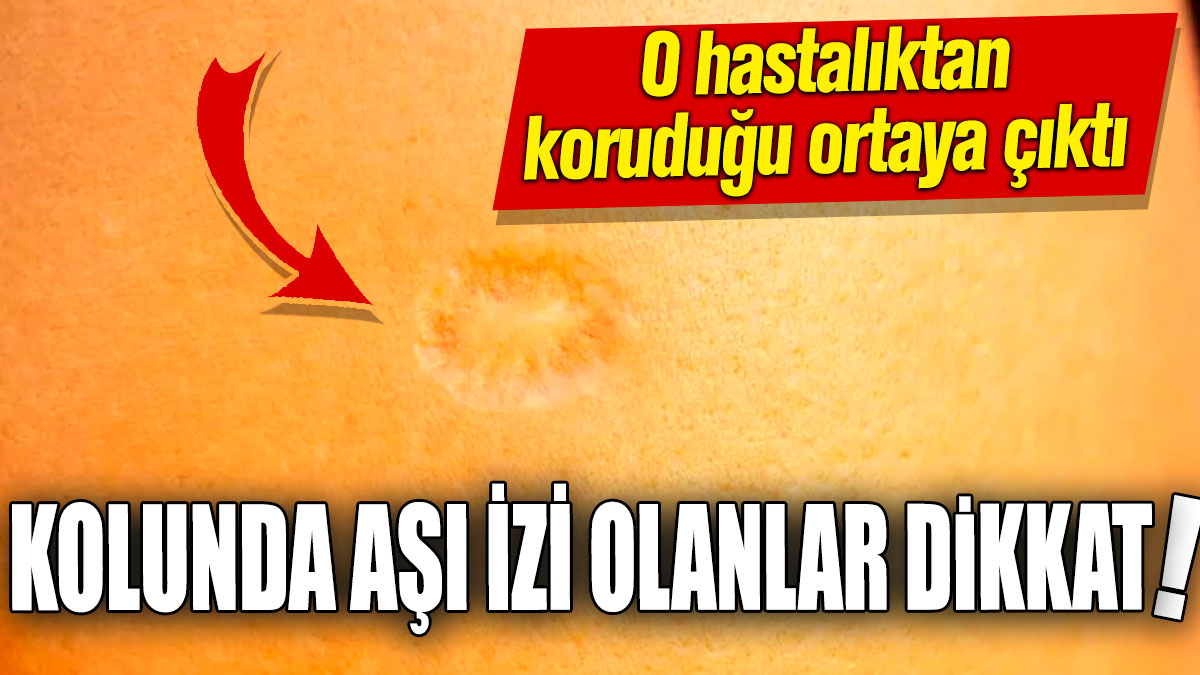 Kolunda aşı izi olanlar dikkat! O hastalıktan koruduğu ortaya çıktı