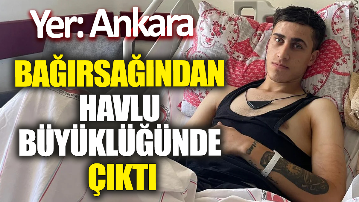 Yer: Ankara! Bağırsağından havlu büyüklüğünde çıktı! Herkesi şoke etti