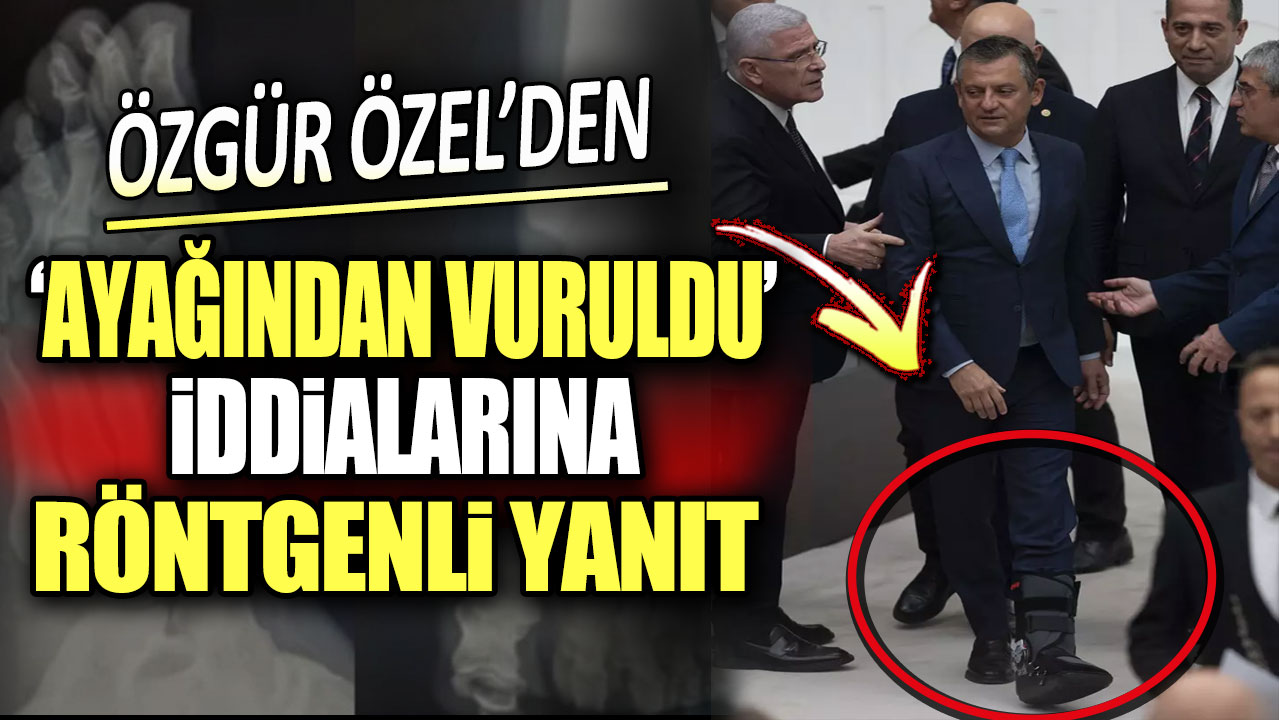 Özgür Özel'den ayağından vuruldu iddialarına röntgenli yanıt