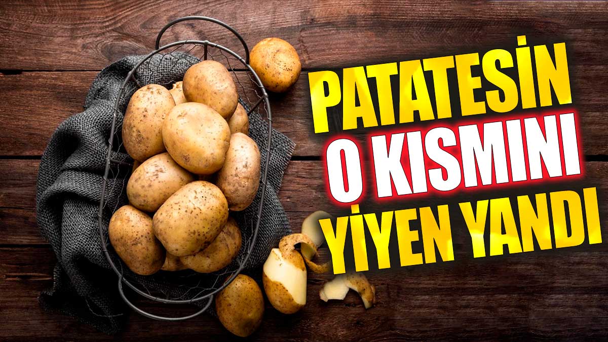 Patatesin o kısmını yiyen yandı