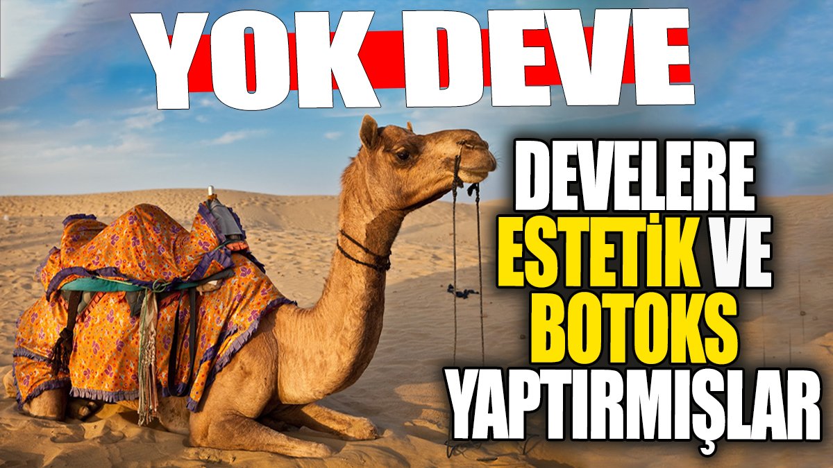 Develere estetik ve botoks yaptırmışlar. Yok devee!