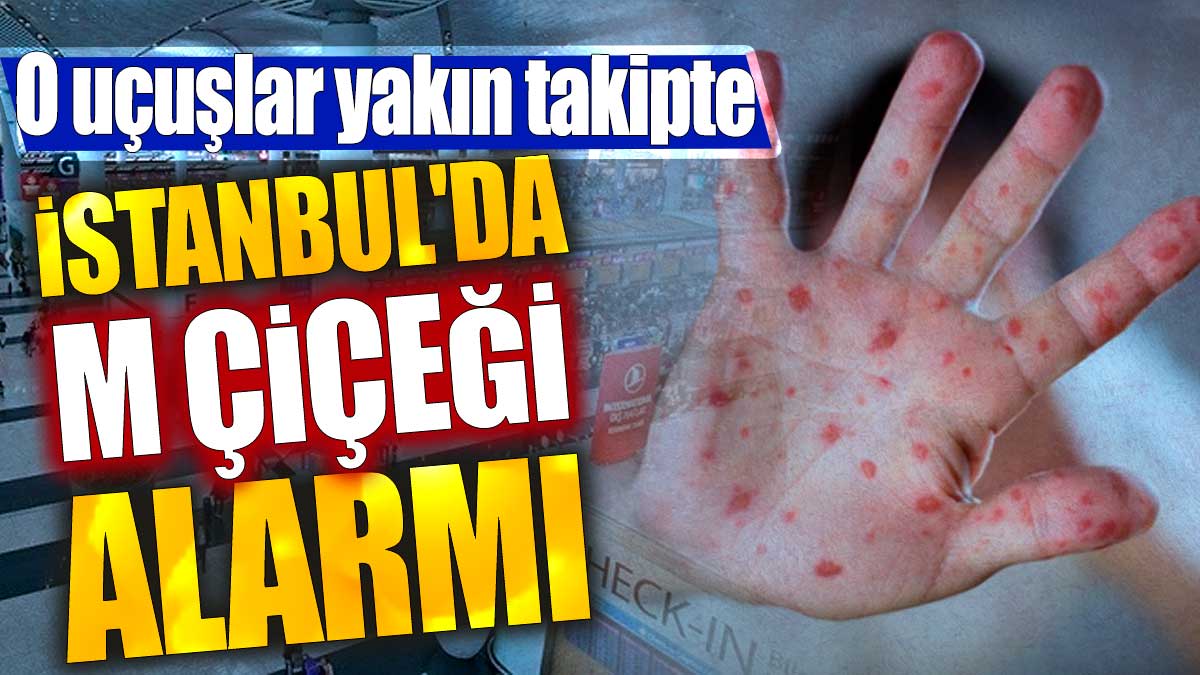 İstanbul'da maymun çiçeği alarmı. O uçuşlar yakın takipte