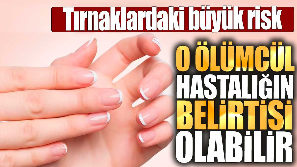 Tırnaklardaki büyük risk: O ölümcül hastalığın belirtisi olabilir