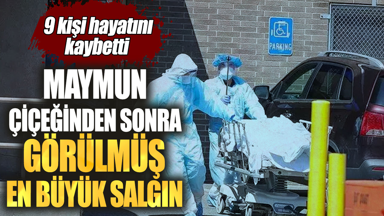 Maymun çiçeğinden sonra görülmüş en büyük salgın!  9 kişi hayatını kaybetti