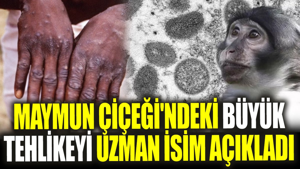 Maymun Çiçeği'ndeki büyük tehlikeyi uzman isim açıkladı