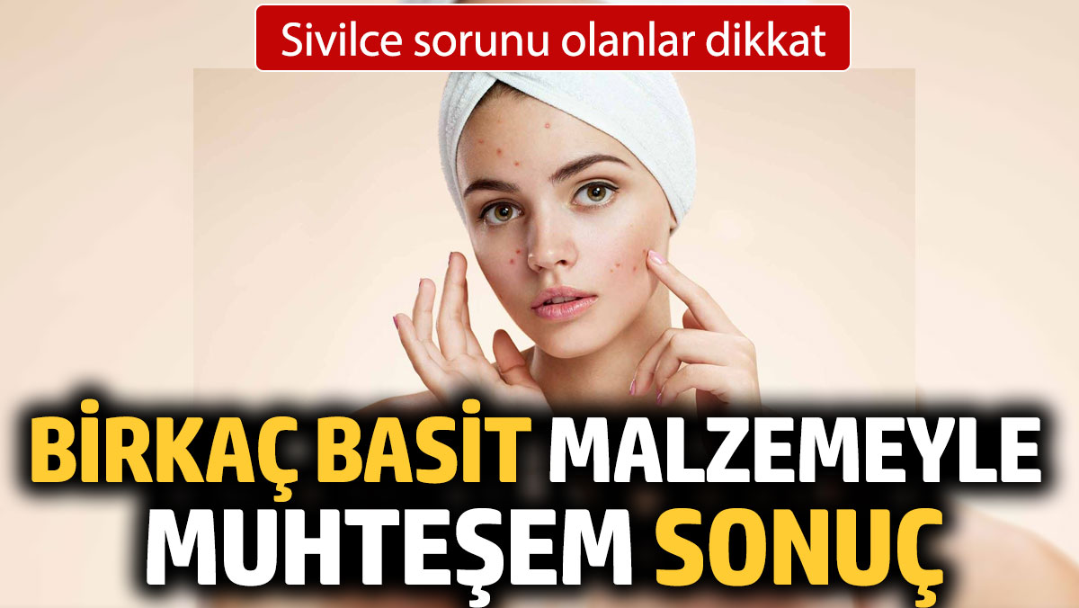 Sivilce sorunu olanlar dikkat. Birkaç basit malzemeyle muhteşem sonuç