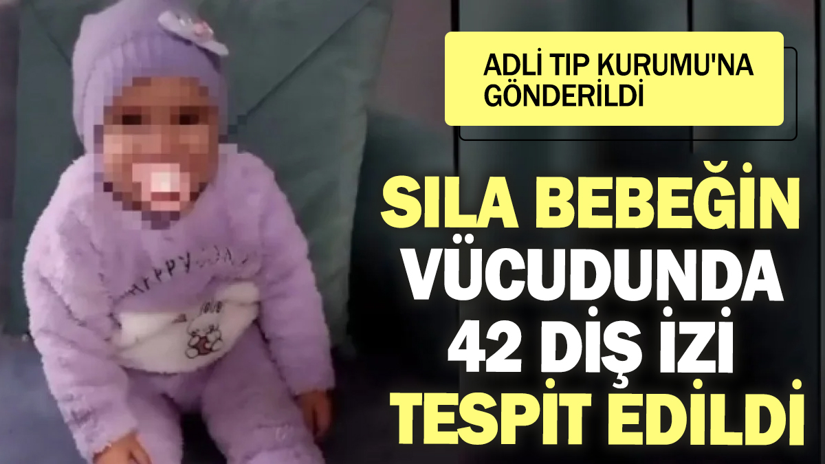 Sıla bebeğin vücudunda 42 dişi izi tespit edildi! Adli Tıp Kurumu'na gönderildi