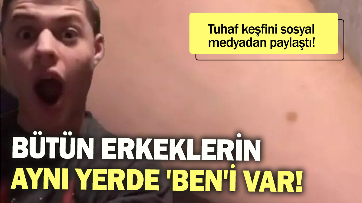 Bütün erkeklerin aynı yerde 'ben'i var! Tuhaf keşfini sosyal medyadan paylaştı...