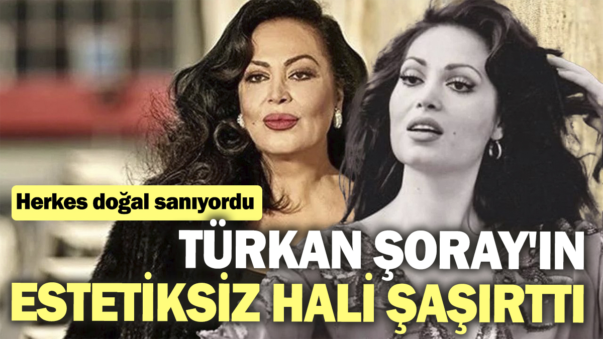 Türkan Şoray'ın estetiksiz hali şaşırttı. Herkes doğal sanıyordu