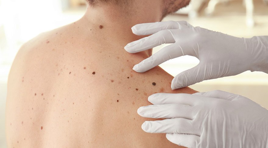 Benlerinizdeki değişiklikler sağlık riskine dönüşebilir