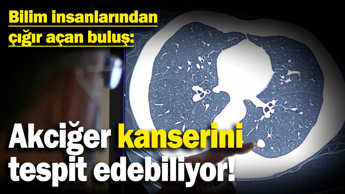 Bilim insanlarından çığır açan buluş: Akciğer kanserini tespit edebiliyor!