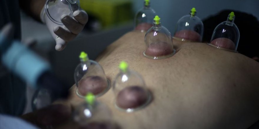 Dr. Saraç: Yılda iki kez hacamat yaptırın