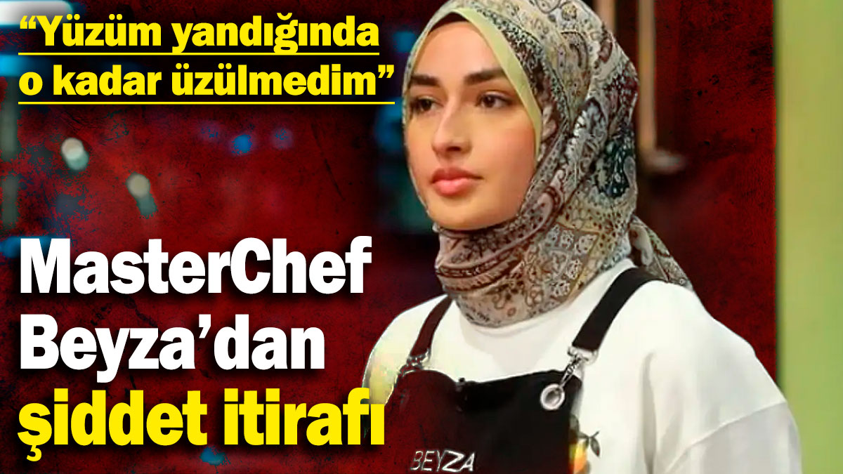 MasterChef Beyza’dan şiddet itirafı! “Yüzüm yandığında o kadar üzülmedim”