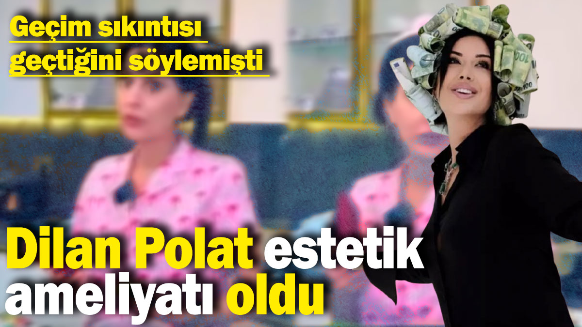 Dilan Polat estetik ameliyatı oldu: Geçtiğimiz günlerde geçim sıkıntısı geçtiğini söylemişti