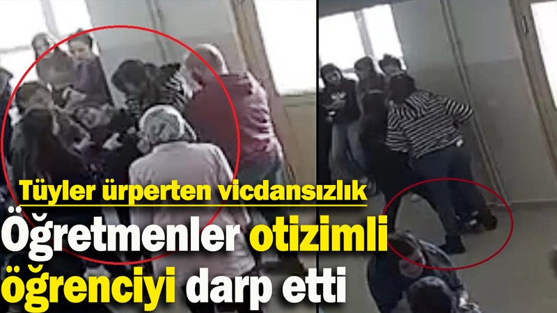 Öğretmenler otizimli  öğrenciyi darp etti: Tüyler ürperten vicdansızlık!