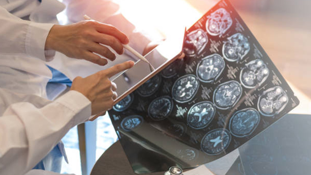 İnsanlar için önemli tavsiye! Demans riskini azaltıyor