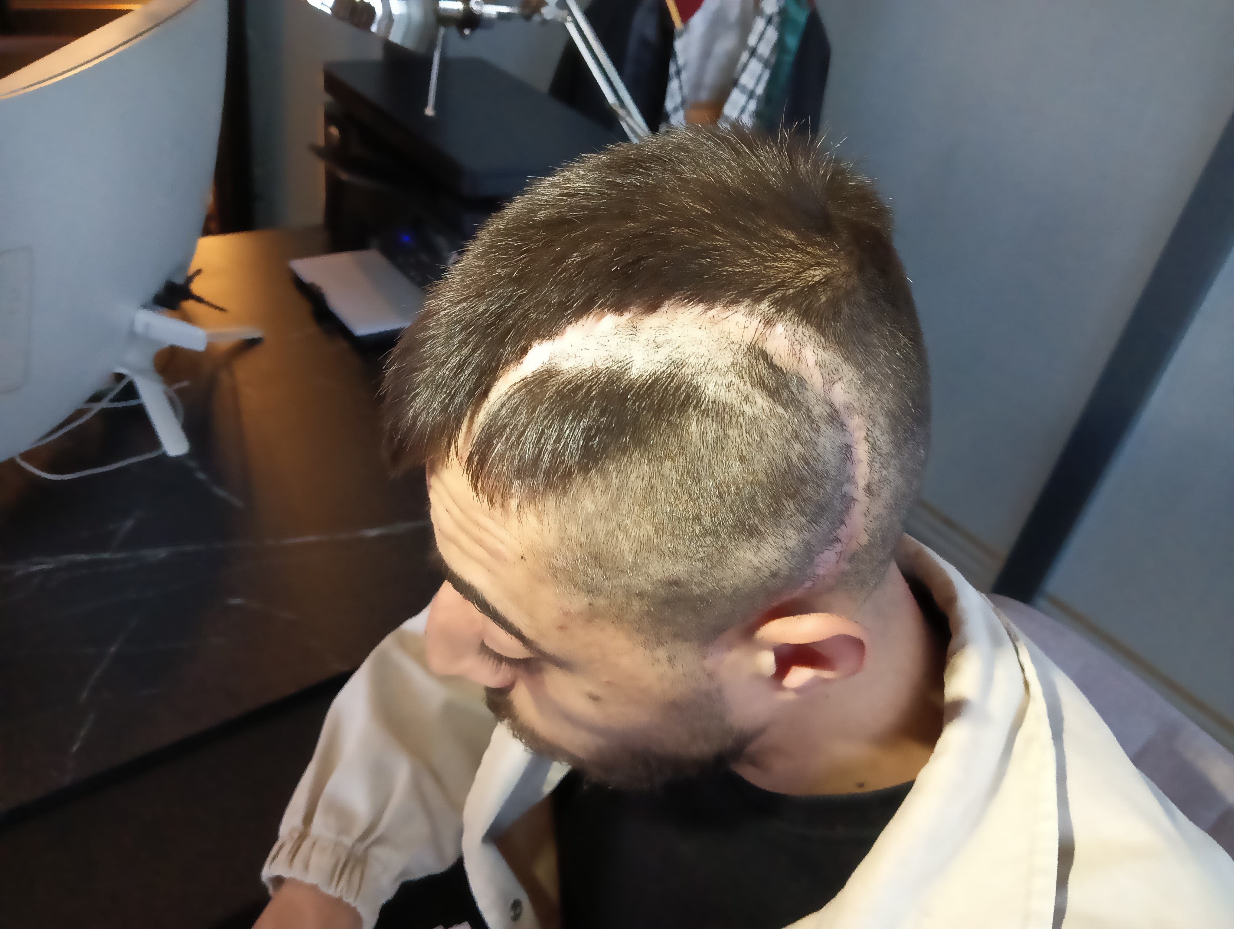 Patronunun darp ettiği çalışan yüzde 32 fiziksel engelli kaldı