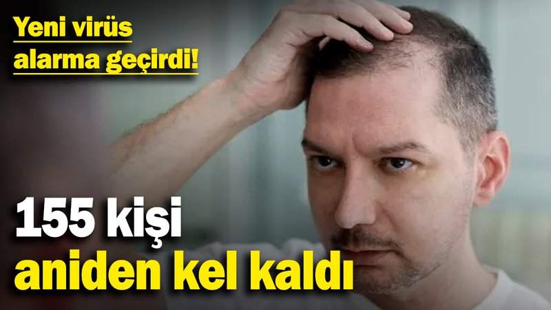 Yeni virüs alarma geçirdi! 155 kişi aniden kel kaldı
