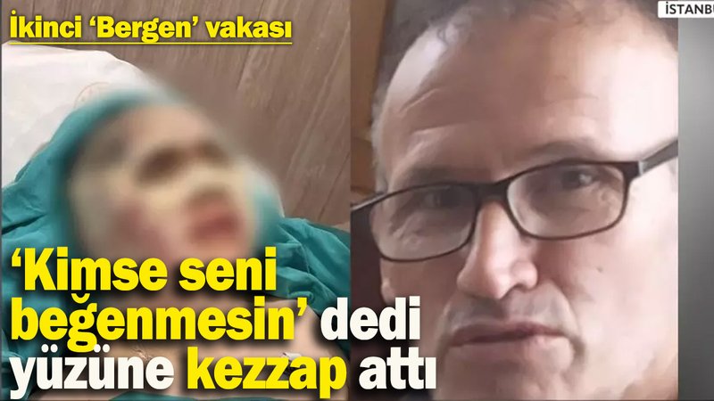 İstanbul’da ikinci 'Bergen' vakası! Saplantılı adam ‘kimse seni beğenmesin’ diyerek yüzüne kezzap attı