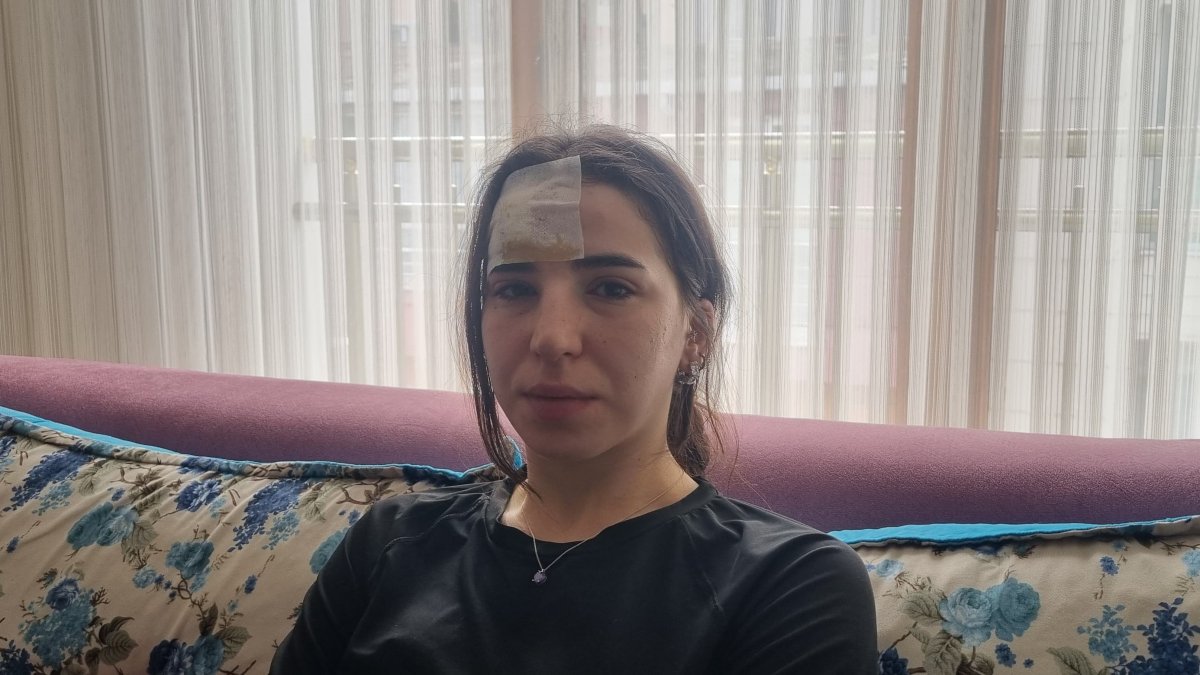 Esenyurt’ta başıboş köpekler bir kadına saldırdı