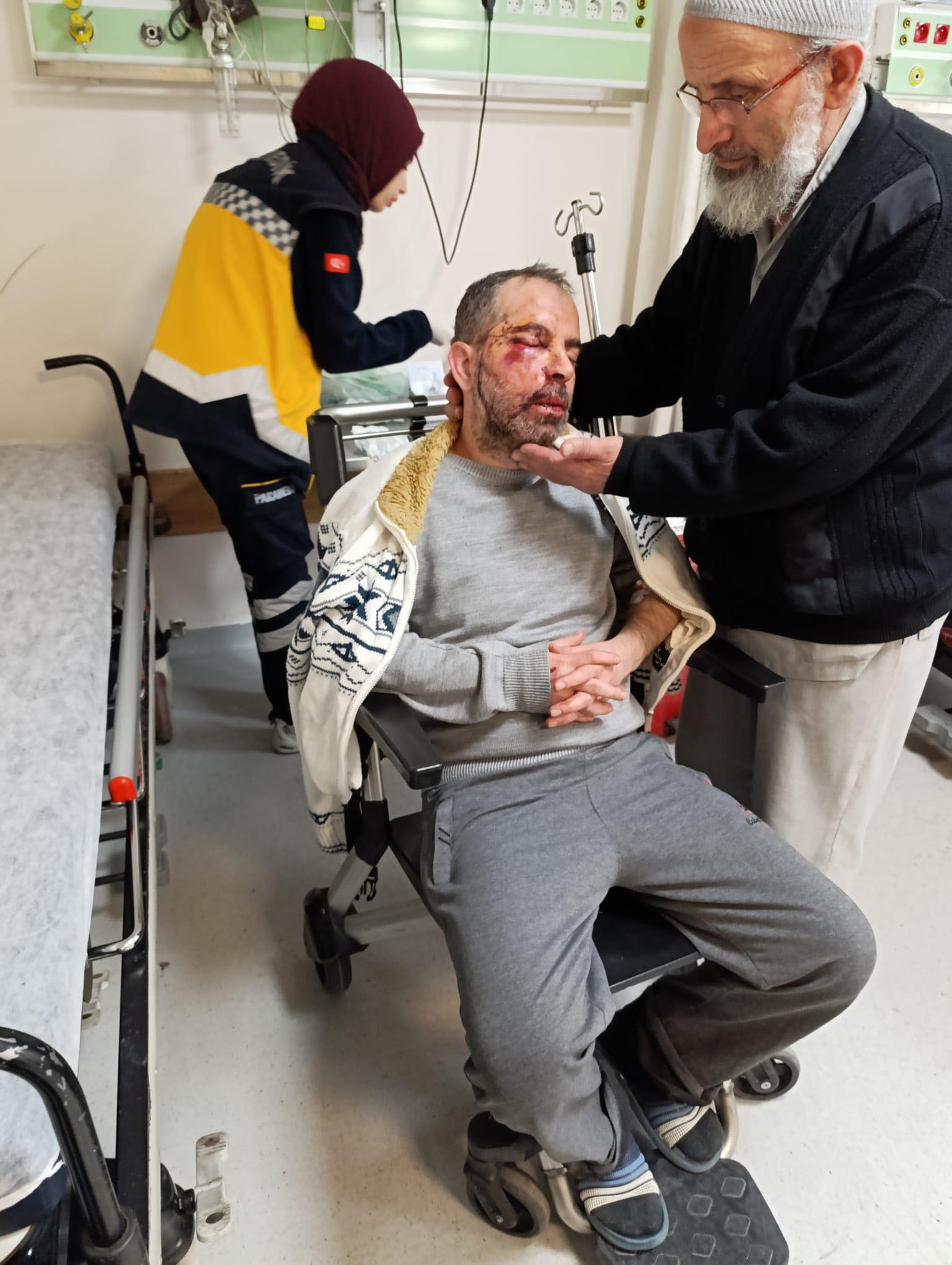 Konya’da köpeklerden kaçarken bisikletten düşüp, yaralandı