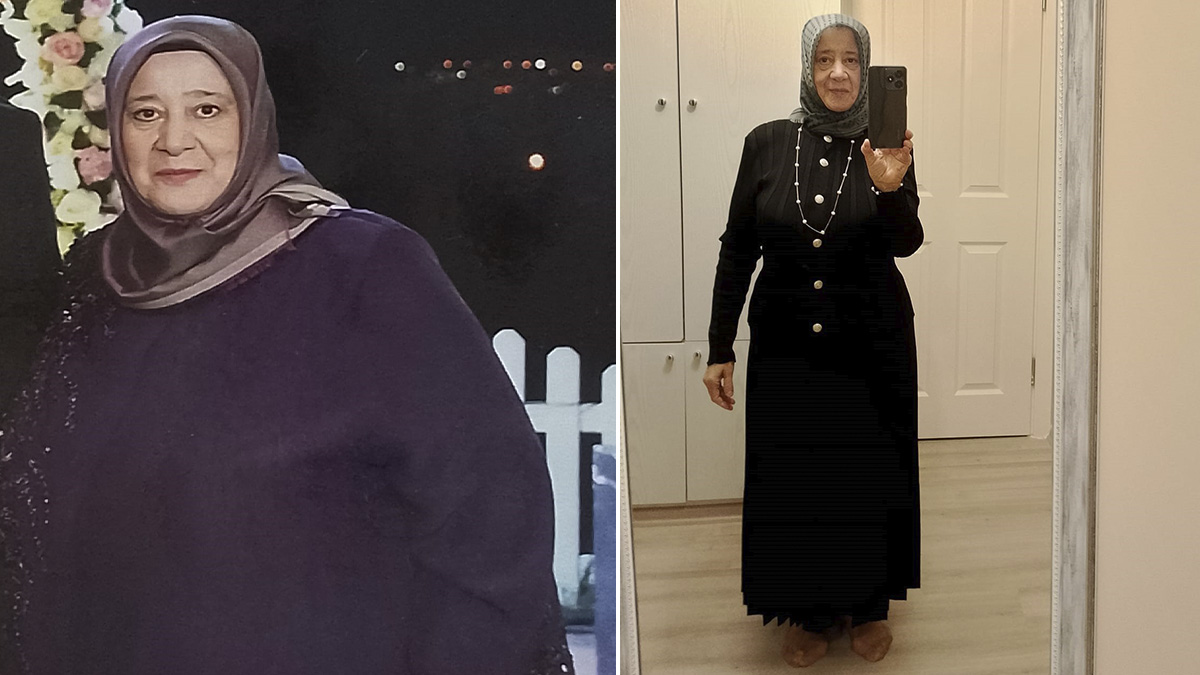 Azmetti 22 ayda 128 kilodan 75 kiloya düştü