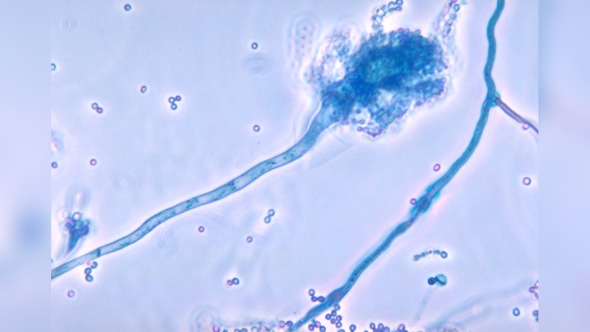 Küresel ısınma, ölümcül mantarın yayılmasını hızlandırabilir