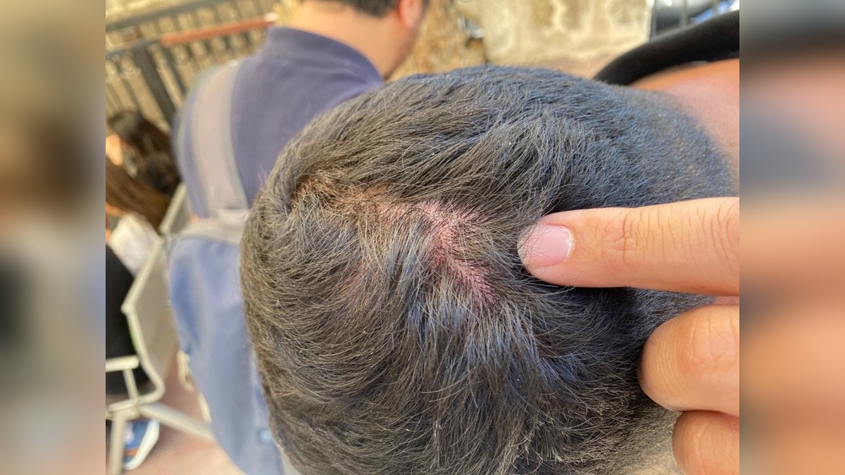 İzmir'de miting hazırlığında vinç kazası: Gazeteciler darbedildi