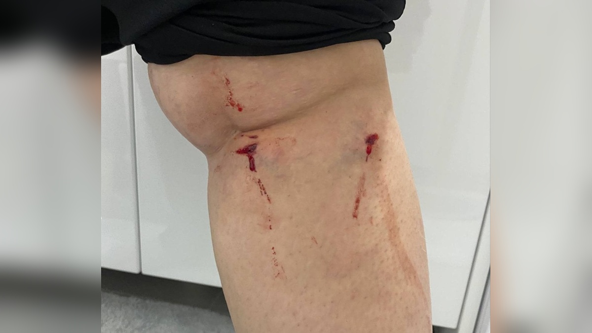 YTÜ Davutpaşa Kampüsü'nde köpek saldırısı: Öğrenci yaralandı