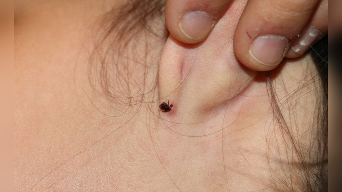 Tarım ve Orman İl Müdürü Çınar'dan KKKA uyarısı: Kişisel korunma şart