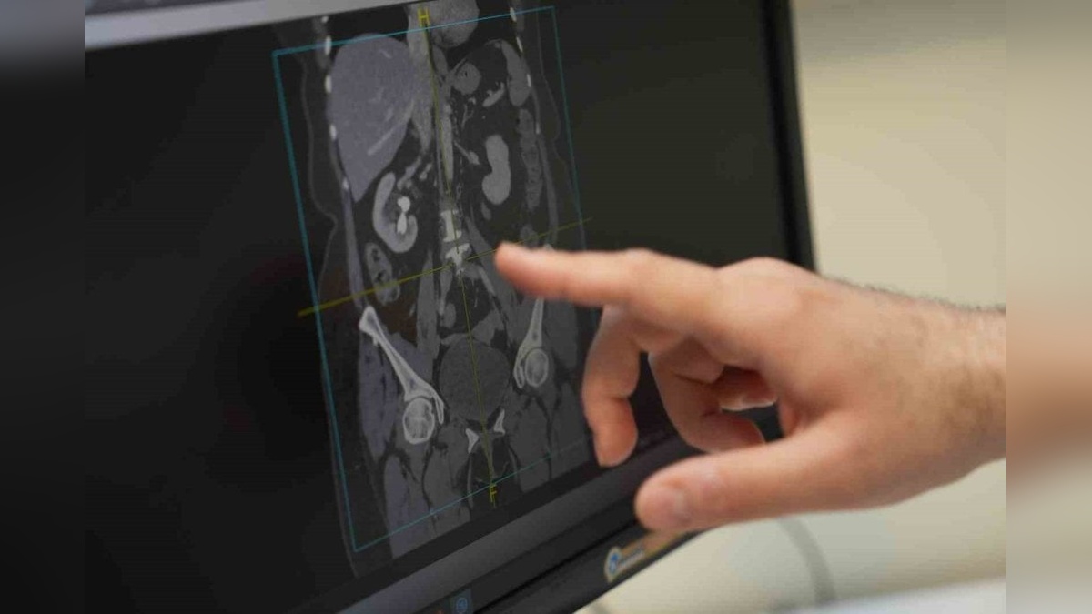 Doç. Dr. Yenice'den erkek cinsel sağlığı için beslenme önerileri