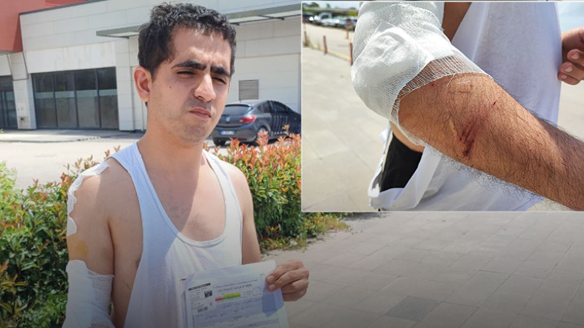 Hastaneye giden gence beklenmedik saldırı! Görenleri şoke etti