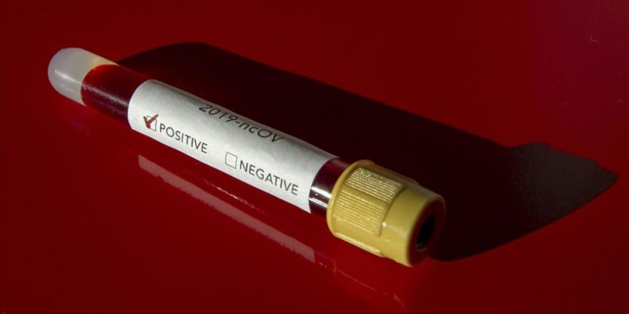 Polonya’da Kovid-19 nedeniyle ilk ölüm