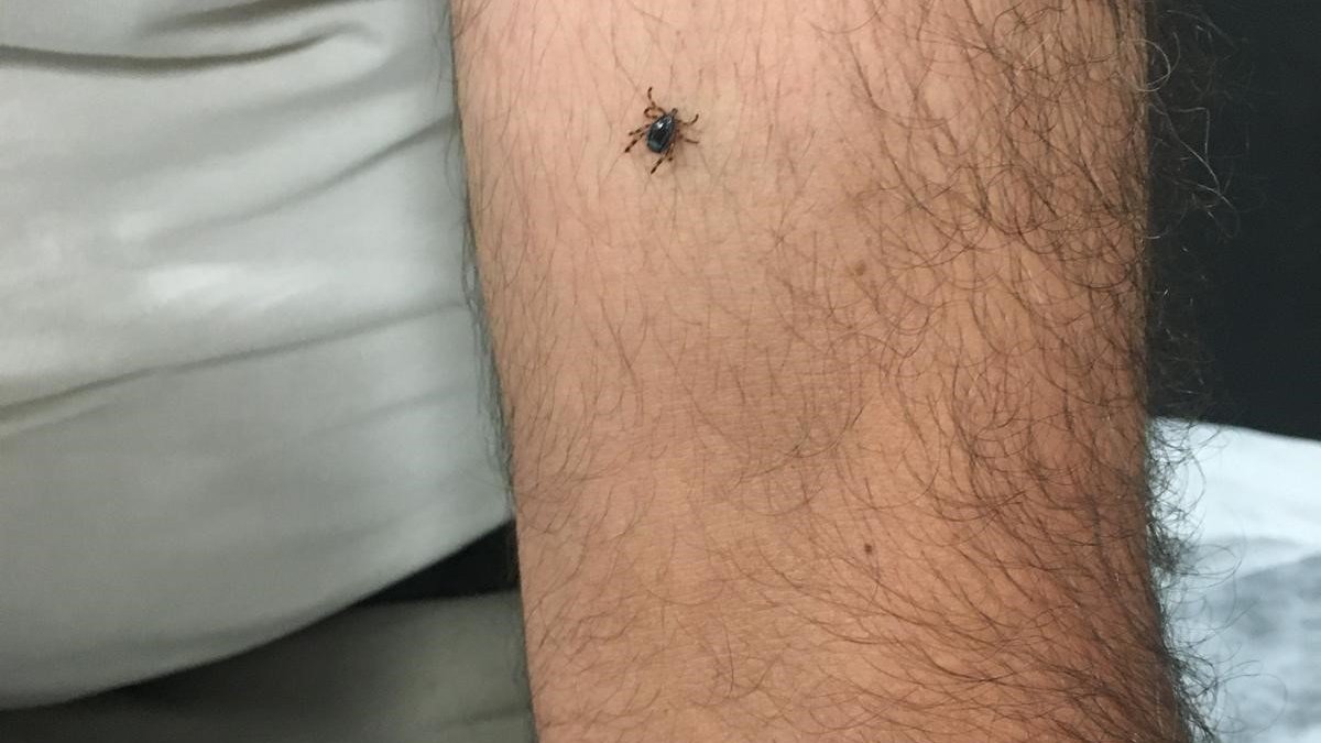 Kayseri’nin bir ilçesinde daha kene vakası!