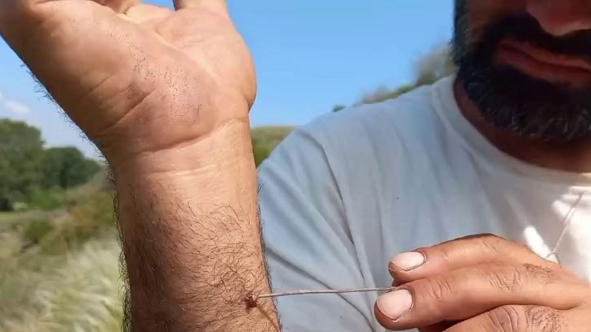 Uzmanından uyarı geldi! Kene vücutta ne kadar kalırsa hastalığın bulaşma riski o kadar artıyor